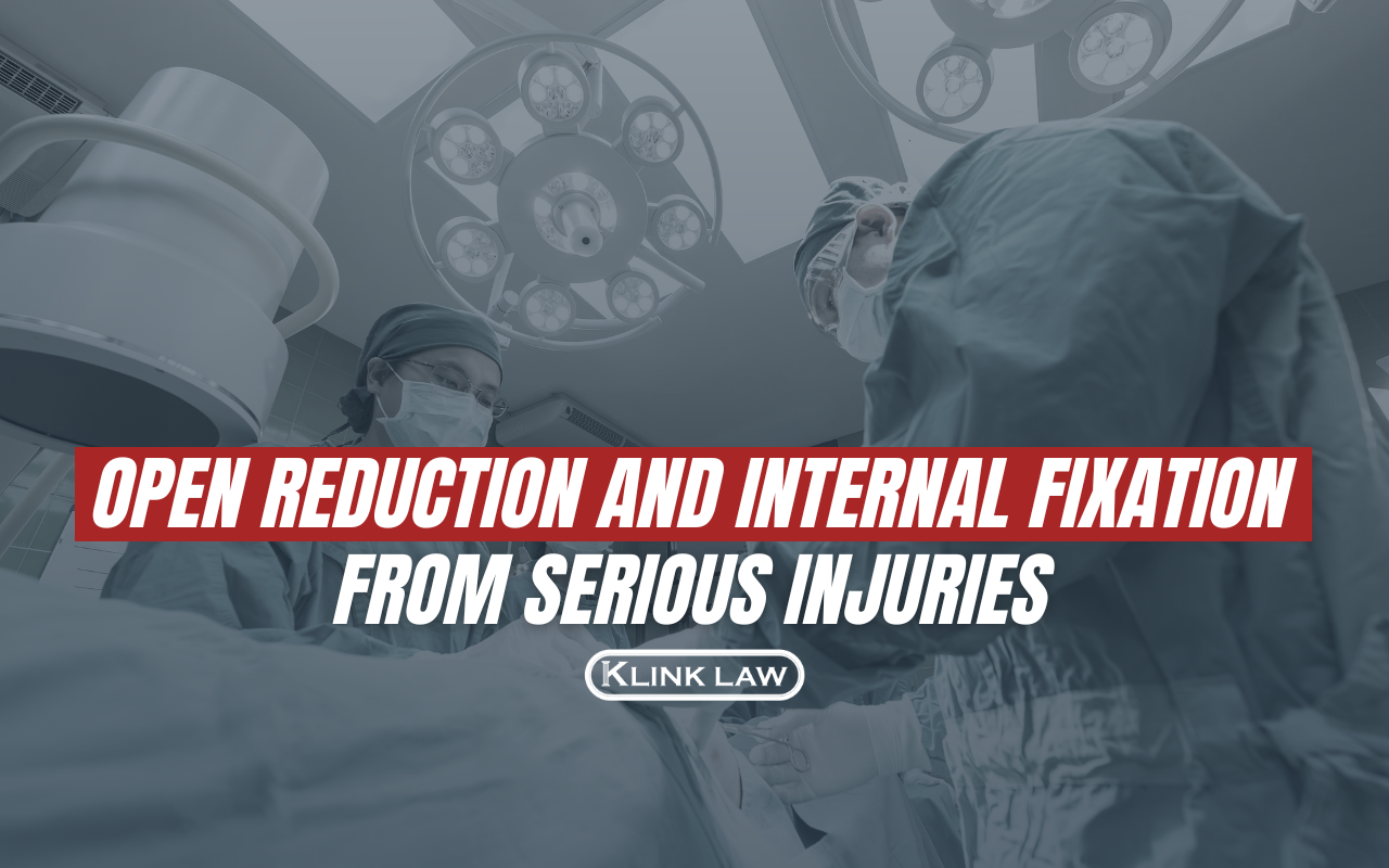 Open Reduction and Internal Fixation From Serious Injuries